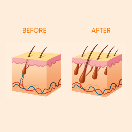 InfraTherm Oil-Infusing Scalp Massager