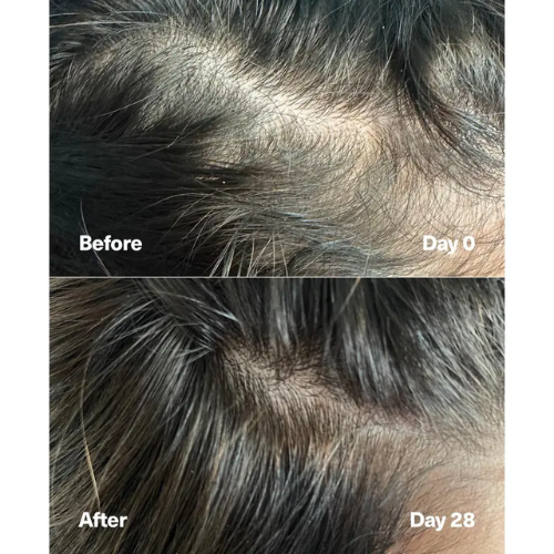 InfraTherm Scalp Massager