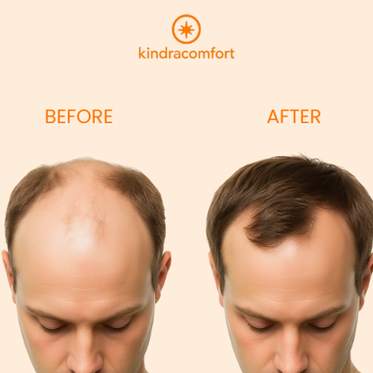 InfraTherm Oil-Infusing Scalp Massager